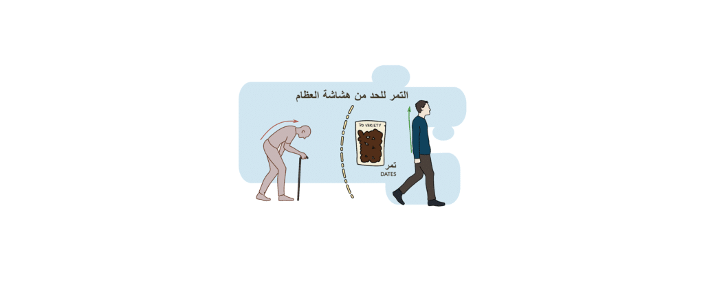 هشاشة العظام
