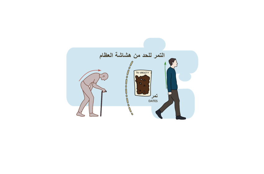 هشاشة العظام